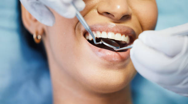 Best Broken or Chipped Tooth Repair in Newville, PA