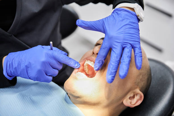 Best Knocked-Out Tooth (Avulsed Tooth) Treatment in Newville, PA
